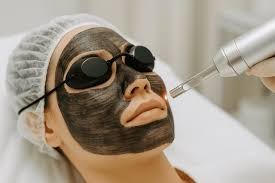 A carbon peel treatment in progress at CURA skin